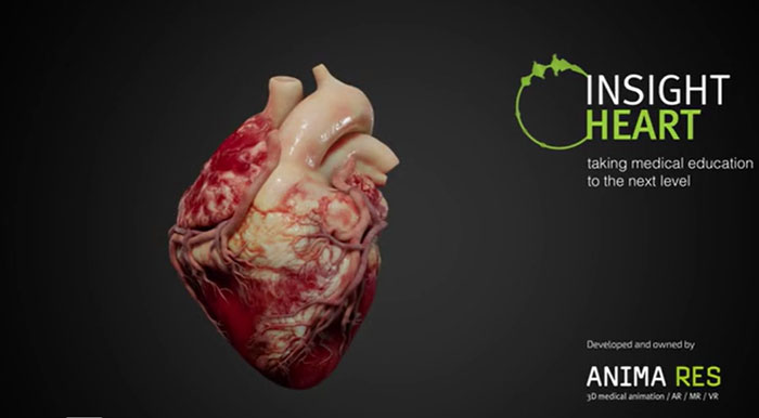 Insight Heart用HoloLens 2为医疗教育实现逼真交互动画模型